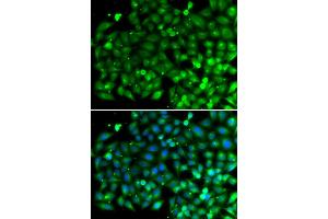 Immunofluorescence analysis of A549 cells using SH3GLB1 antibody. (SH3GLB1 anticorps)