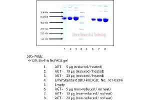 Gel Scan of Angiotensinogen, Human Plasma  This information is representative of the product ART prepares, but is not lot specific. (AGT Protéine)