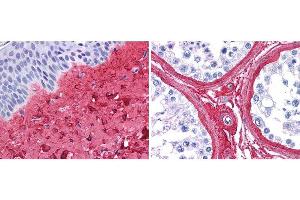 Immunohistochemistry (IHC) image for anti-Collagen, Type III (COL3) antibody (ABIN5596830)