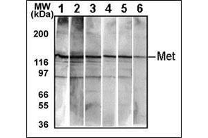 Western Blotting (WB) image for anti-Met Proto-Oncogene (MET) (Catalytic Domain) antibody (ABIN356340) (c-MET anticorps  (Catalytic Domain))