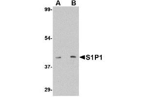 Image no. 1 for anti-Sphingosine-1-Phosphate Receptor 1 (S1PR1) (C-Term) antibody (ABIN342723) (S1PR1 anticorps  (C-Term))