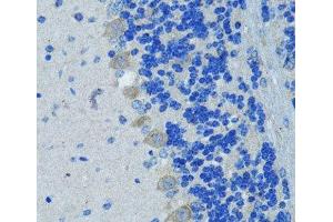 Immunohistochemistry of paraffin-embedded Mouse brain using Nestin Polyclonal Antibody at dilution of 1:100 (40x lens). (Nestin anticorps)