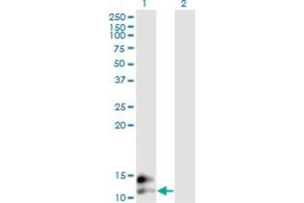 Osteocalcin anticorps  (AA 52-100)