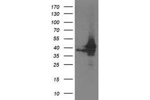 Western Blotting (WB) image for anti-ATG3 Autophagy Related 3 (ATG3) antibody (ABIN1496763) (ATG3 anticorps)