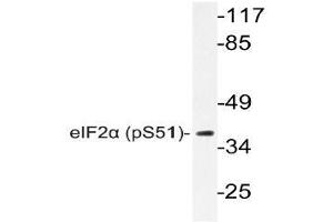 Western blot (WB) analyzes of p-eIF2alpha antibody in extracts from Jurkat insulin cells. (EIF2S1 anticorps  (pSer51))