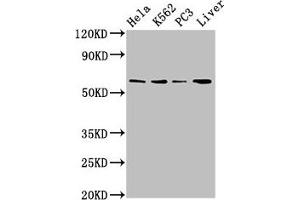 Western Blot Positive WB detected in: Hela whole cell lysate, K562 whole cell lysate, PC-3 whole cell lysate, Mouse liver tissue All lanes: RORA antibody at 2. (RORA anticorps  (AA 110-214))