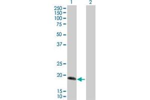 Western Blot analysis of IL17C expression in transfected 293T cell line by IL17C MaxPab polyclonal antibody. (IL17C anticorps  (AA 1-197))