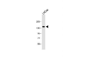 Anti-POTEE Antibody (Center) at 1:1000 dilution + LNCap whole cell lysate Lysates/proteins at 20 μg per lane. (POTEE anticorps  (AA 380-409))