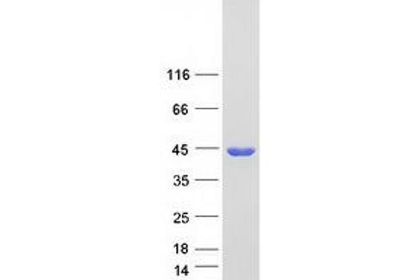 ADH1A Protein (Myc-DYKDDDDK Tag)