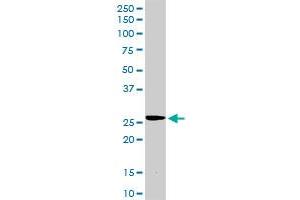 TIMP2 MaxPab rabbit polyclonal antibody. (TIMP2 anticorps  (AA 1-220))