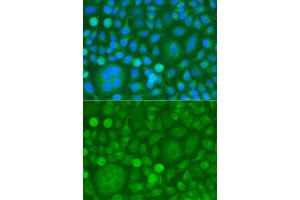 Immunofluorescence analysis of HeLa cells using EPM2A antibody. (EPM2A anticorps)