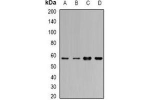 Western blot analysis of Cytochrome P450 1A1 expression in MCF7 (A), BT474 (B), mouse lung (C), mouse liver (D) whole cell lysates. (CYP1A1 anticorps)