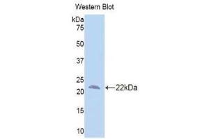 Western Blotting (WB) image for anti-Interleukin 10 Receptor, beta (IL10RB) (AA 87-243) antibody (ABIN1174853) (IL10RB anticorps  (AA 87-243))