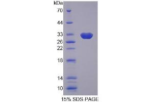 SDS-PAGE analysis of Human GBP2 Protein. (GBP2 Protéine)