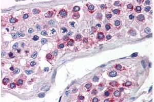 Human Testis (formalin-fixed, paraffin-embedded) stained with ATG16L1 antibody ABIN351446 at 5 ug/ml followed by biotinylated goat anti-rabbit IgG secondary antibody ABIN481713, alkaline phosphatase-streptavidin and chromogen. (ATG16L1 anticorps  (N-Term))