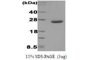 Figure annotation denotes ug of protein loaded and % gel used. (DsbC Protéine)