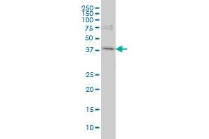 Western Blotting (WB) image for anti-Polymerase (RNA) I Polypeptide C, 30kDa (POLR1C) (AA 1-347) antibody (ABIN599084) (POLR1C anticorps  (AA 1-347))