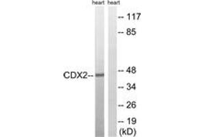 Western blot analysis of extracts from rat heart, using CDX2 (Ab-283) Antibody. (CDX2 anticorps  (AA 249-298))