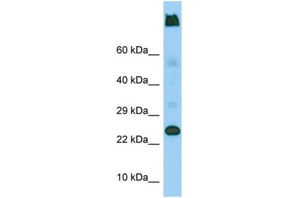 LY6G5C anticorps  (C-Term)