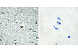 Peptide - + (BAI1 anticorps  (Internal Region))