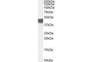 Western Blotting (WB) image for anti-Argininosuccinate Synthase 1 (ASS1) (Internal Region) antibody (ABIN2466477) (ASS1 anticorps  (Internal Region))