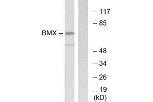 Western Blotting (WB) image for anti-BMX Non-Receptor Tyrosine Kinase (BMX) (N-Term) antibody (ABIN1849423) (BMX anticorps  (N-Term))