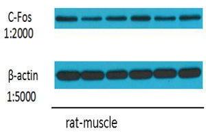 Western Blot (WB) analysis: Please contact us for more details. (c-FOS anticorps)