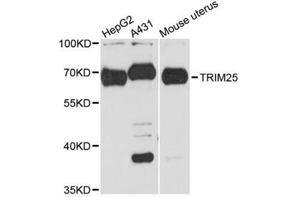 TRIM25 anticorps  (AA 100-400)