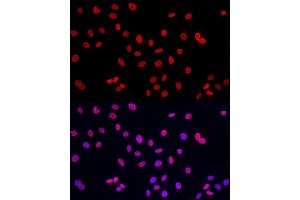 Immunofluorescence analysis of A-549 cells using Lamin A/C Rabbit pAb (ABIN6133798 and ABIN6143078) at dilution of 1:150 (40x lens). (Lamin A/C anticorps)