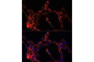 Immunofluorescence analysis of NIH/3T3 cells using J antibody (ABIN6129288, ABIN6142632, ABIN6142634 and ABIN6216477) at dilution of 1:100. (JAG1 anticorps  (AA 34-180))