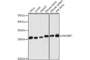 Western blot analysis of extracts of various cell lines, using R Rabbit pAb (ABIN7269841) at 1:2000 dilution. (RANBP1 anticorps  (AA 1-100))