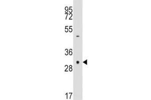 Western blot analysis of anti-Caspase-3 antibody and NCI-H460 lysate. (Caspase 3 anticorps  (AA 60-90))