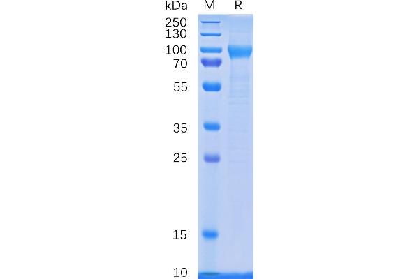 CSF3R Protein (AA 25-622) (His tag)