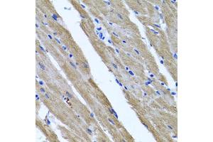 Immunohistochemistry of paraffin-embedded rat heart using DFNA5 antibody (ABIN5975144) at dilution of 1/100 (40x lens). (DFNA5 anticorps)
