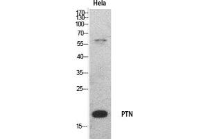 Western Blot analysis of hela cells using PTN Polyclonal Antibody. (Pleiotrophin anticorps  (Internal Region))