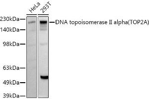 Western blot analysis of extracts of various cell lines, using DNA topoisomerase II alpha (TOP2A) antibody (ABIN7270853) at 1:1000 dilution. (Topoisomerase II alpha anticorps  (AA 1050-1150))