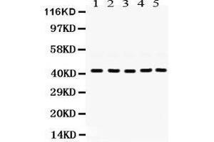 Western Blotting (WB) image for anti-Guanine Nucleotide Binding Protein (G Protein), Q Polypeptide (GNAQ) (AA 102-138), (N-Term) antibody (ABIN3043833) (GNAQ anticorps  (N-Term))