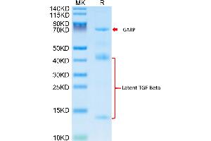 Mouse GARP&Latent TGF beta Complex on Tris-Bis PAGE under reduced condition. (GARP & Latent TGF beta 1 Complex (AA 18-628) protein (His tag))