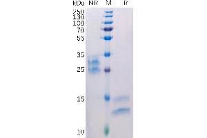 VEGFA Protein (AA 27-147) (His tag)