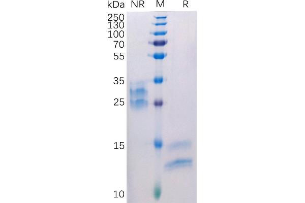 VEGFA Protein (AA 27-147) (His tag)