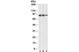 Western blot of human (A), mouse (B) and rat (C) adipose lysates with Aconitase 2 antibody at 0. (ACO2 anticorps)