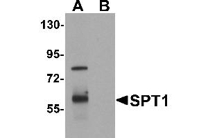 Western blot analysis of SPT1 in human lung tissue lysate with SPT1 antibody at 1 µg/mL in (A) the absence and (B) the presence of blocking peptide. (SPTLC1 anticorps  (C-Term))