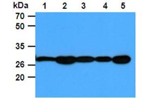 The Cell lysates (40ug) were resolved by SDS-PAGE, transferred to PVDF membrane and probed with anti-human PGAM1 antibody (1:1000). (PGAM1 anticorps)