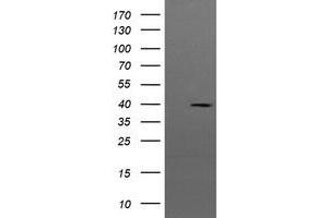Image no. 2 for anti-Mitogen-Activated Protein Kinase Kinase 3 (MAP2K3) antibody (ABIN1499420) (MAP2K3 anticorps)