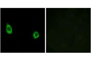 Immunofluorescence analysis of HuvEc cells, using CHST9 Antibody. (CHST9 anticorps  (AA 361-410))