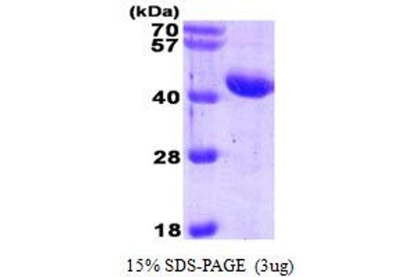 SERPINA3 Protein (AA 24-423) (His tag)