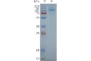 Human R3-Nanodisc, Flag Tag on SDS-PAGE (TAS1R3 Protéine)