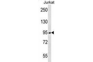 Western Blotting (WB) image for anti-Transmembrane Protease, serine 15 (TMPRSS15) antibody (ABIN2996619) (TMPRSS15 anticorps)