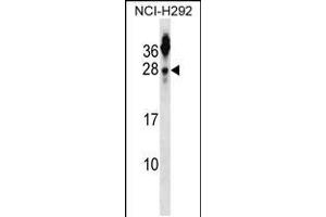 Western blot analysis in NCI-H292 cell line lysates (35ug/lane). (Tetraspanin 2 anticorps  (N-Term))