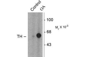 Image no. 2 for anti-Tyrosine Hydroxylase (TH) (pSer31) antibody (ABIN227933) (Tyrosine Hydroxylase anticorps  (pSer31))